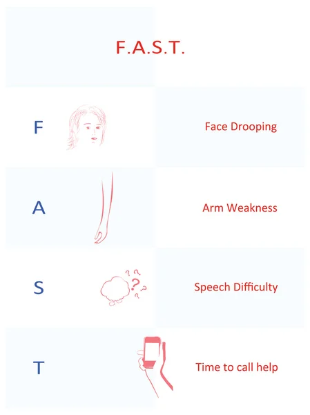 Lema "Rápido": recordatorio de los signos y síntomas del accidente cerebrovascular — Vector de stock