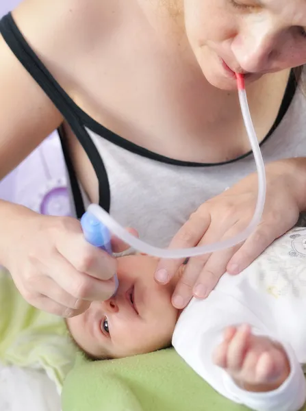 Neonato con naso che cola . — Foto Stock