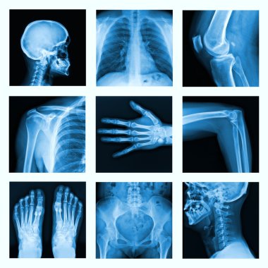 Collage of many X-rays in very good quality. clipart