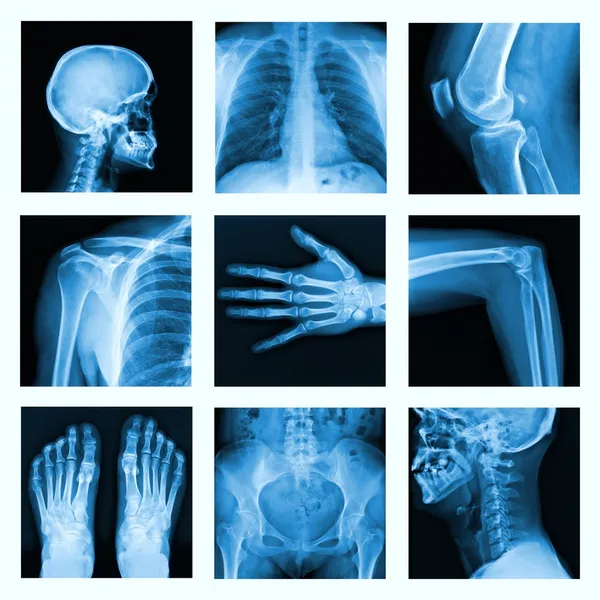 Collage of many X-rays in very good quality. — Stock fotografie