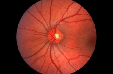 Human Retina - Optic Nerve