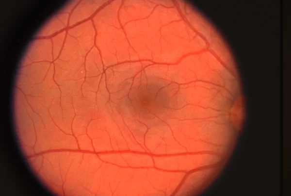 视网膜 — 图库照片