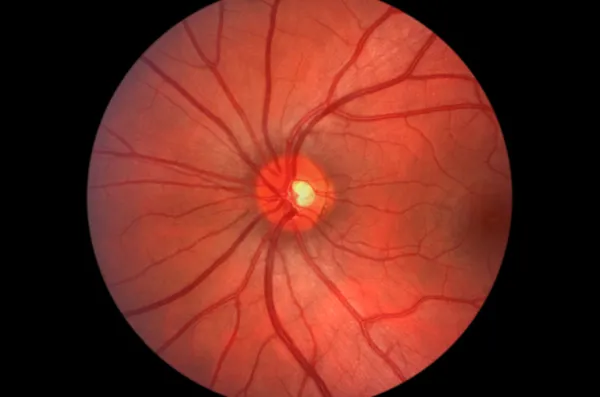 Retina humana - Nervio óptico Imágenes de stock libres de derechos