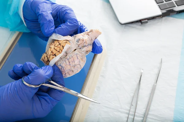 Pathologiste ouvrant un échantillon de tissu dans le laboratoire — Photo