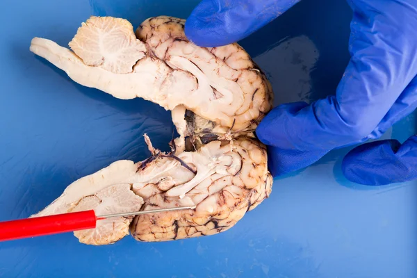 Продольное поперечное сечение мозга коровы — стоковое фото