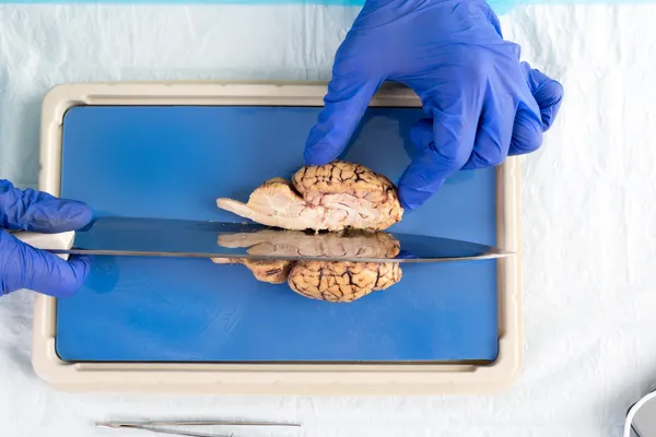 Student in a laboratory slicing a cow brain — Stock Photo, Image