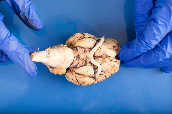 Студент-физиолог, препарирующий мозг — стоковое фото