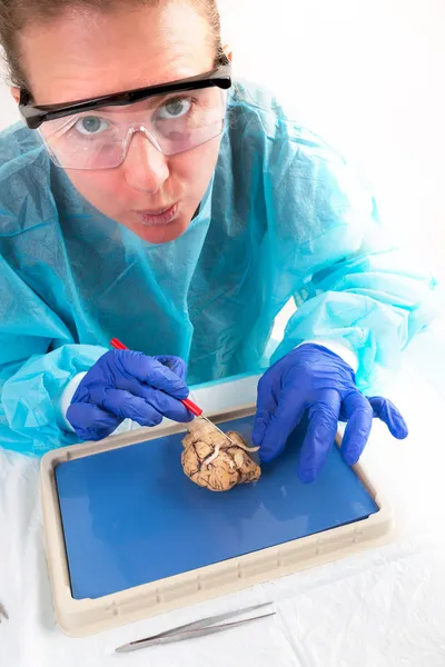 Corte accidental de nervios ópticos en el cerebro —  Fotos de Stock