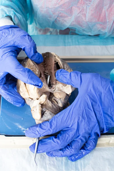 Student in medical school dissecting a heart — Stock Photo, Image