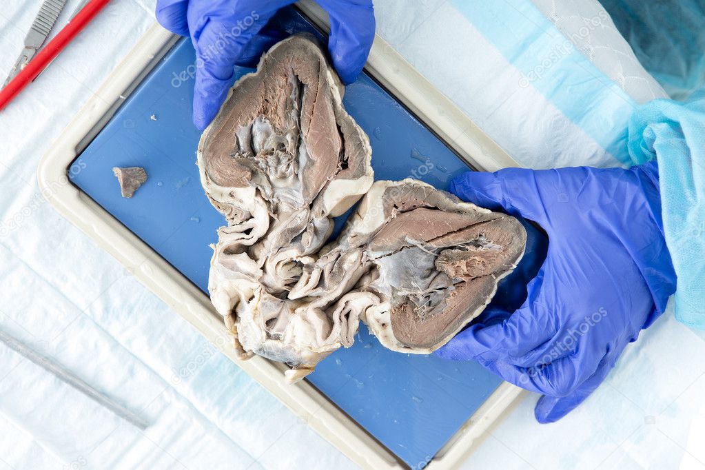 Medical student displaying a bisected heart