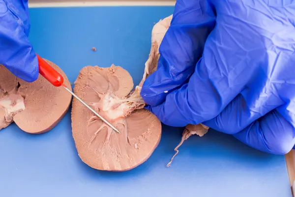 Estudiante estudiando un riñón de oveja disecado — Foto de Stock