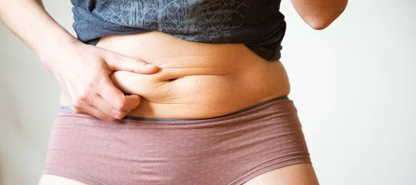 Mulher Verificando Barriga Gordura Conceito Peso Solto — Fotografia de Stock
