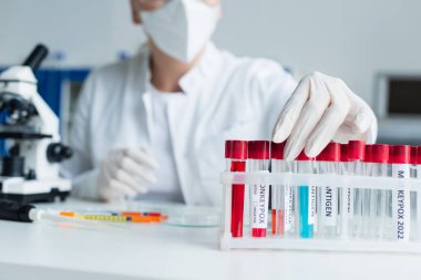Bulanık bir bilim adamının laboratuarda maymun çiçeği harfleriyle test tüpü alışının görüntüsü. 