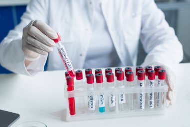 Cropped view of scientist holding test tube with monkeypox lettering in laboratory 