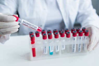 Bulanık bir bilim adamının laboratuarda maymun çiçeği harfleriyle test tüpü tutarken görüntüsü. 