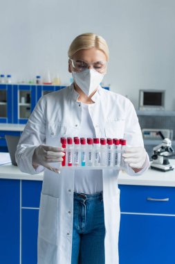 Koruyucu maskeli bir araştırmacı laboratuarda maymun çiçeği harfleriyle test tüpleri tutuyor. 