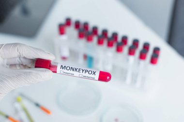 Cropped view of scientist in latex glove holding test tube with monkeypox lettering in blurred laboratory