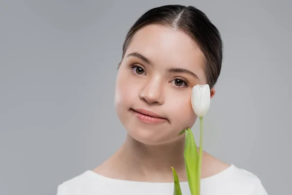 Jeune femme atteinte du syndrome duvet tenant la tulipe près du visage isolé sur gris — Photo de stock