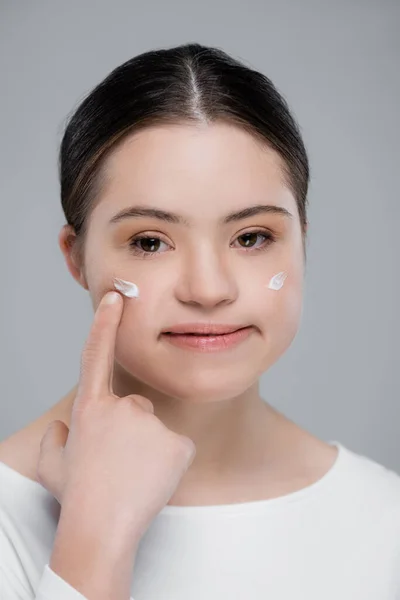 Woman with down syndrome pointing at cream on face isolated on grey — Stock Photo