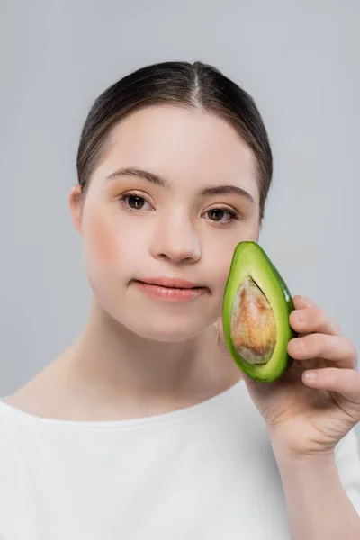 Woman with down syndrome holding fresh avocado isolated on grey — Stock Photo