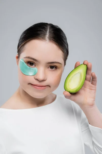 Frau mit Down-Syndrom und Augenklappe hält Avocado isoliert auf grau — Stockfoto