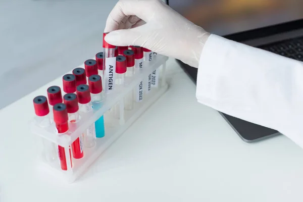 Обрезанный вид ученого, принимающего пробирку с антигенной надписью возле ноутбука в лаборатории — стоковое фото
