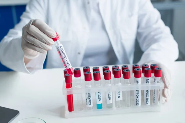 Cropped view of scientist holding test tube with monkeypox lettering in laboratory — Stock Photo