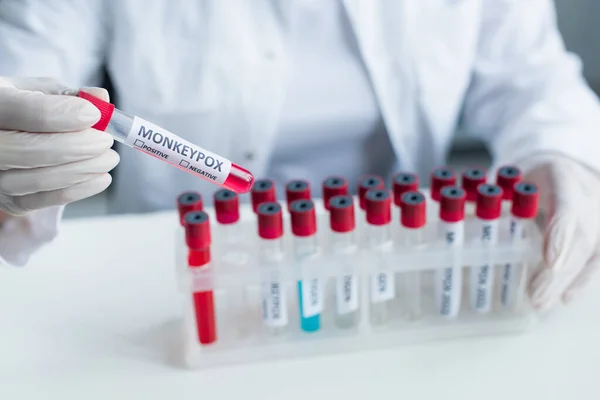 Vista cortada do tubo de teste de retenção de cientista desfocado com letras de varíola em laboratório — Fotografia de Stock