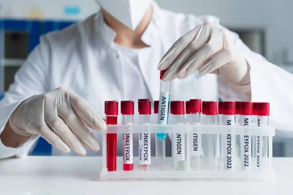 Cropped view of scientist in latex gloves taking test tube with antigen lettering in lab — стоковое фото