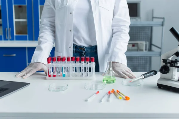 Vista cortada do cientista em pé perto de tubos de ensaio com letras de varíola e microscópio em laboratório — Fotografia de Stock