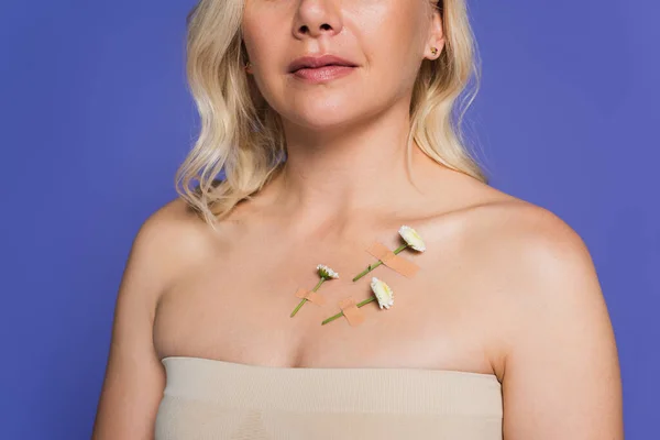 Abgeschnittene Ansicht einer blonden Frau mit Pflaster und weißen Blumen auf dem Körper isoliert auf lila — Stockfoto