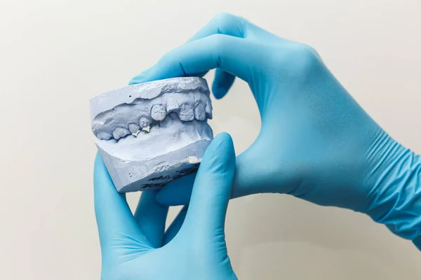 Orthodontist Holds Cast Childs Jaw His Hands — Stock fotografie