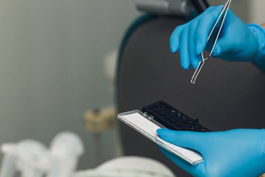 the orthodontist takes the button for braces with forceps