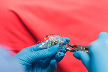 close-up of a dentist preparing braces for a patient