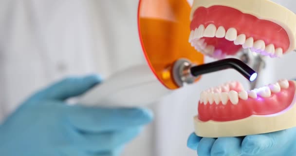 Dentysta z rękawiczkami świecącymi utwardzacz światła maszyna do sztucznego plastiku model szczęki 4k film — Wideo stockowe