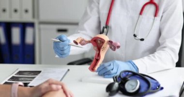Doktor jinekolog rahim ve yumurtalık modelinde hasta kadın hastalıkları gösteriyor.