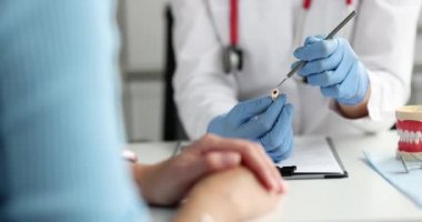 Doktor dişçi hasta plastiği gösteriyor. Hasta dişi 4K filmi.