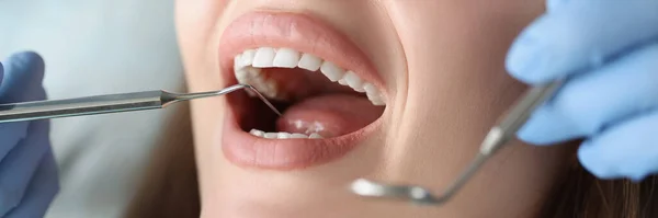 치과의 사는 여성 환자의 구강 강을 검사한다 — 스톡 사진