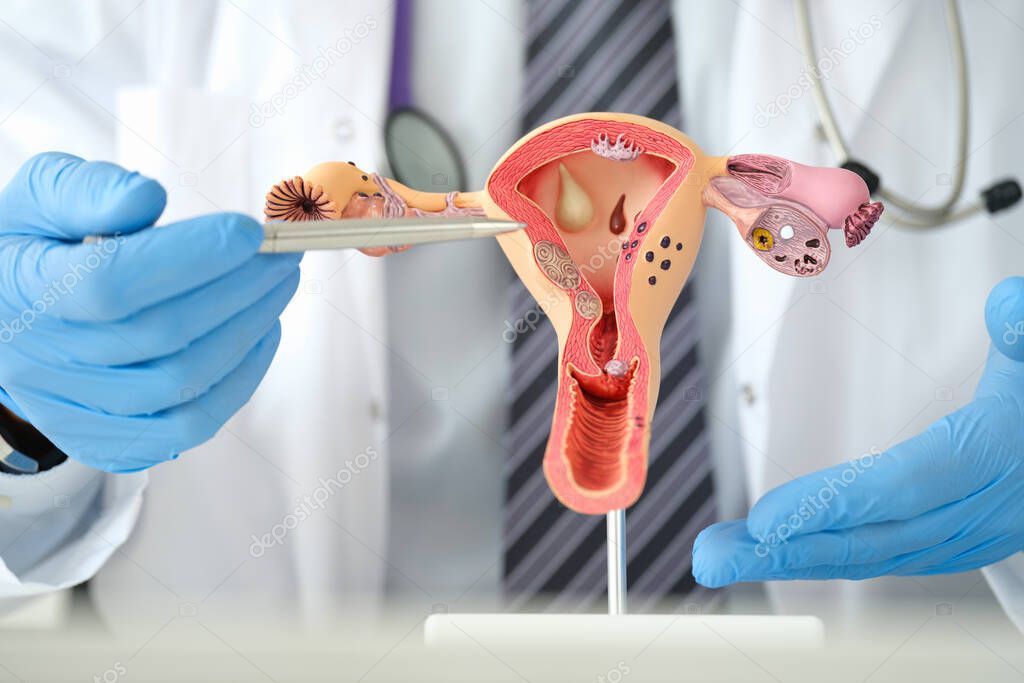 Man gynecologist showing female diseases with pen on plastic artificial model of uterus and ovaries closeup