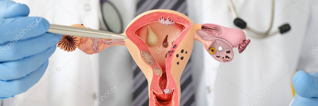 Doctor holding dummy of uterus with ovaries to university closeup