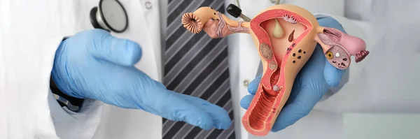 Doctor in rubber gloves holding plastic mock-up of female uterus in clinic closeup — Stock Photo, Image