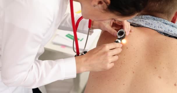 Orvos onkológus vizsgálata beteg pigmentált Nevus segítségével dermatoscope 4k film — Stock videók