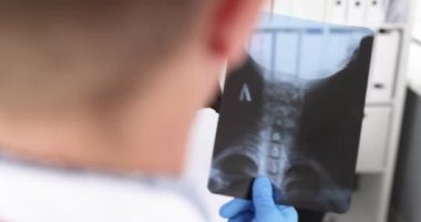 Doktor nörolog servikal omurga röntgeni tutuyor ve boyun 4K filminde ağrı noktalarına baskı yapıyor.