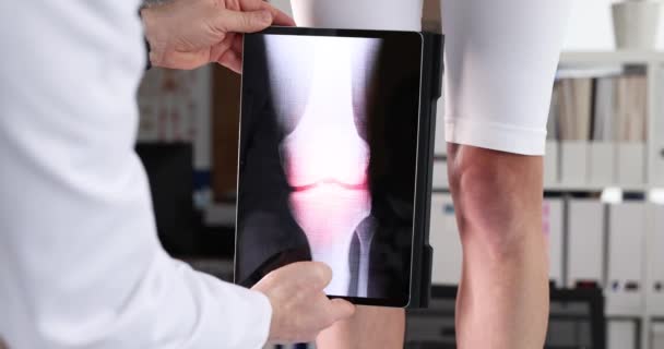 Médico haciendo examen por computadora de la articulación de la rodilla usando la película digital de la tableta 4k — Vídeo de stock