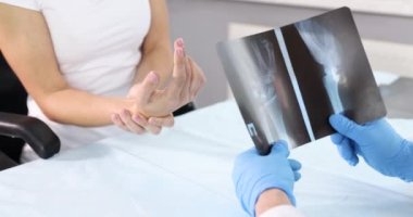 Doktor romatolog hasta 4K filminin arka planında el röntgeni tutuyor.