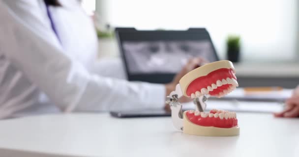 医師と患者の近くのテーブルの上に立っている顎の人工的なモックアップ4k映画 — ストック動画