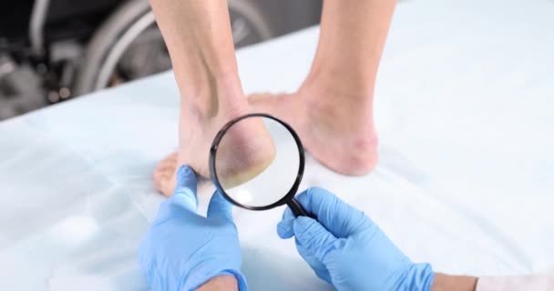 Lékař dermatolog s lupou zkoumá nohy a podpatky ženy zpomalený film 4k — Stock video