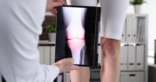 Врач-травматолог сканирует женскую боль в колене с помощью цифрового планшета в клинике 4К кино замедленной съемки — стоковое видео