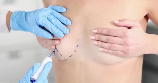 Kesztyűs plasztikai sebész kezei sebészeti vonalakat rajzolnak a gyönyörű nő mellkasára lassított felvételű 4K film — Stock videók