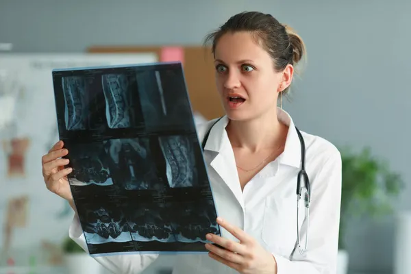 Femme surprise médecin professionnel avec le résultat du patient sur les rayons X — Photo